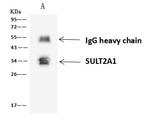 SULT2A1 Antibody in Immunoprecipitation (IP)