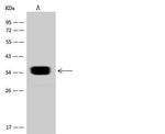 SULT2A1 Antibody in Western Blot (WB)