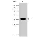 SULT2A1 Antibody in Western Blot (WB)