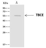 TBCE Antibody in Immunoprecipitation (IP)