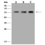 TBCE Antibody in Western Blot (WB)