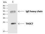 THOC7 Antibody in Immunoprecipitation (IP)