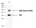 TST Antibody in Immunoprecipitation (IP)