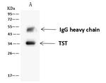 TST Antibody in Immunoprecipitation (IP)