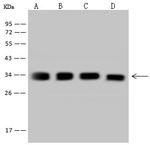 TST Antibody in Western Blot (WB)