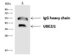 UBE2J1 Antibody in Immunoprecipitation (IP)