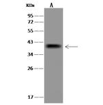 UBE2J1 Antibody in Western Blot (WB)