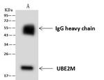 UBE2M Antibody in Immunoprecipitation (IP)