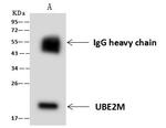 UBE2M Antibody in Immunoprecipitation (IP)