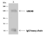 UBE4B Antibody in Immunoprecipitation (IP)