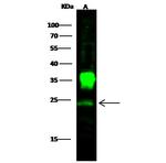 PGP9.5 Antibody in Western Blot (WB)