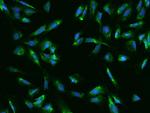 UCKL1 Antibody in Immunocytochemistry (ICC/IF)