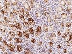 UCKL1 Antibody in Immunohistochemistry (Paraffin) (IHC (P))