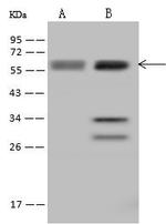 UCKL1 Antibody in Western Blot (WB)