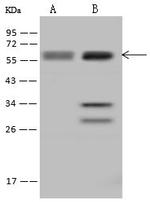 UCKL1 Antibody in Western Blot (WB)