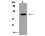 USP13 Antibody in Western Blot (WB)