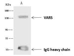 VARS Antibody in Immunoprecipitation (IP)