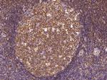 VASP Antibody in Immunohistochemistry (Paraffin) (IHC (P))