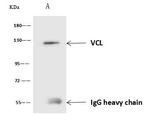 Vinculin Antibody in Immunoprecipitation (IP)