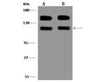 Vinculin Antibody in Western Blot (WB)