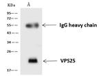 VPS25 Antibody in Immunoprecipitation (IP)