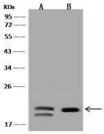 VPS25 Antibody in Western Blot (WB)