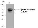 VPS26B Antibody in Immunoprecipitation (IP)