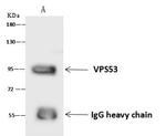 VPS53 Antibody in Immunoprecipitation (IP)