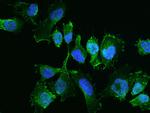 YES1 Antibody in Immunocytochemistry (ICC/IF)