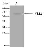 YES1 Antibody in Immunoprecipitation (IP)