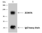 ZC3H7A Antibody in Immunoprecipitation (IP)