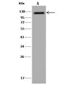 ZC3H7A Antibody in Western Blot (WB)