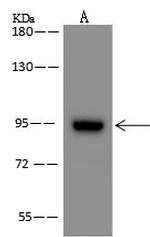 ZNF711 Antibody in Western Blot (WB)