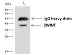 ZWINT Antibody in Immunoprecipitation (IP)