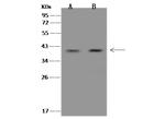 ZWINT Antibody in Western Blot (WB)