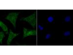 HMGB2 Antibody in Immunocytochemistry (ICC/IF)