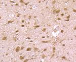 HMGB2 Antibody in Immunohistochemistry (Paraffin) (IHC (P))