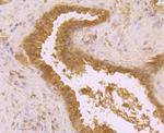 BMAL1 Antibody in Immunohistochemistry (Paraffin) (IHC (P))