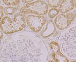 KCNK1 Antibody in Immunohistochemistry (Paraffin) (IHC (P))