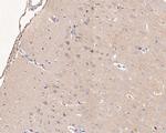 LGI1 Antibody in Immunohistochemistry (Paraffin) (IHC (P))