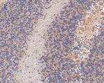 LGI1 Antibody in Immunohistochemistry (Paraffin) (IHC (P))