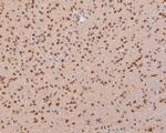 COPS8 Antibody in Immunohistochemistry (Paraffin) (IHC (P))