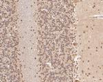 COPS8 Antibody in Immunohistochemistry (Paraffin) (IHC (P))