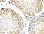 Dysferlin Antibody in Immunohistochemistry (Paraffin) (IHC (P))