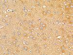 Dysferlin Antibody in Immunohistochemistry (Paraffin) (IHC (P))