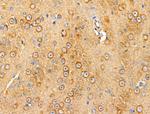 Dysferlin Antibody in Immunohistochemistry (Paraffin) (IHC (P))