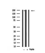 Dysferlin Antibody in Western Blot (WB)