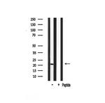 MSC Antibody in Western Blot (WB)