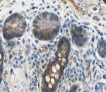 APRIL Antibody in Immunohistochemistry (Paraffin) (IHC (P))