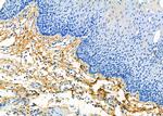 COL14A1 Antibody in Immunohistochemistry (Paraffin) (IHC (P))